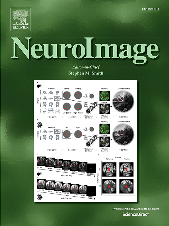 Go to journal home page - NeuroImage